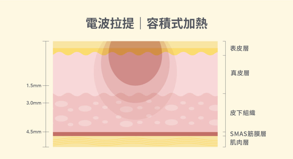 電波是什麼