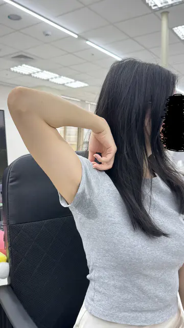 腋下止汗前