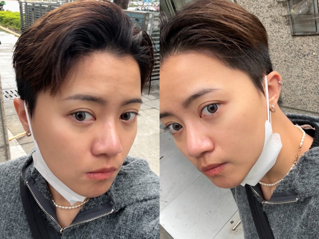 美白水光術前