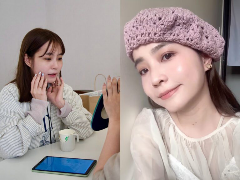 三倍光術後效果