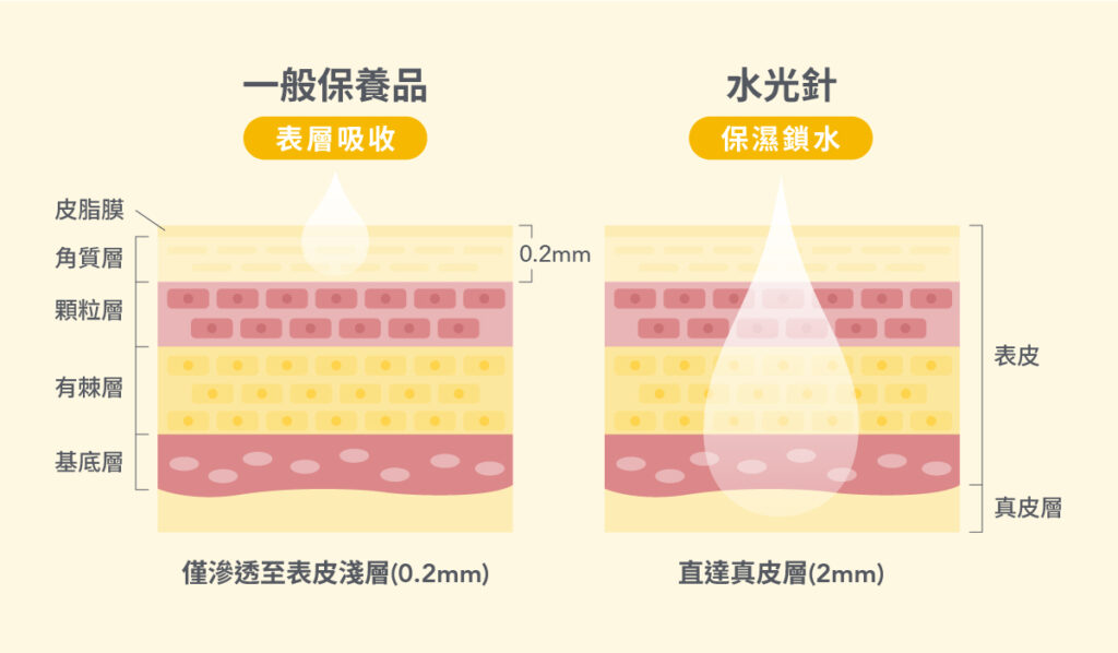 水光針是什麼-2