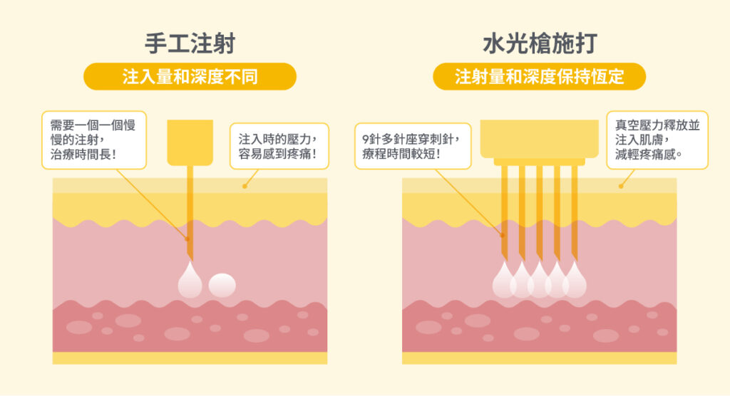 水光針手打-5