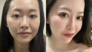 埋線鼻雕蔡欣容封面