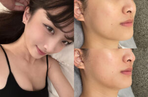 25-0609 海菲秀Sydeo
