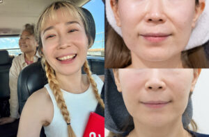 25-0613 我們倆Nina-法令紋