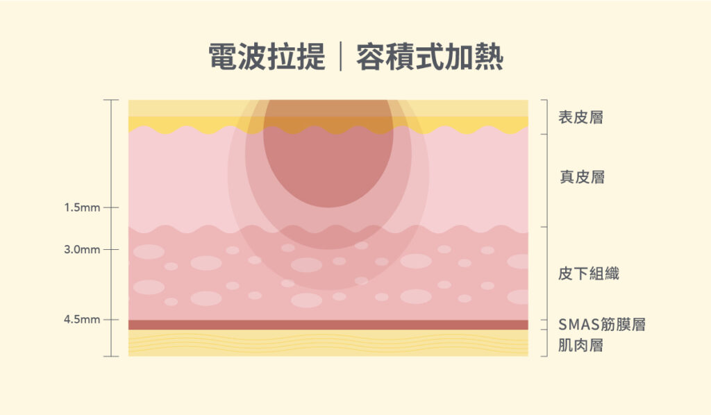 電音波維持肌齡-2