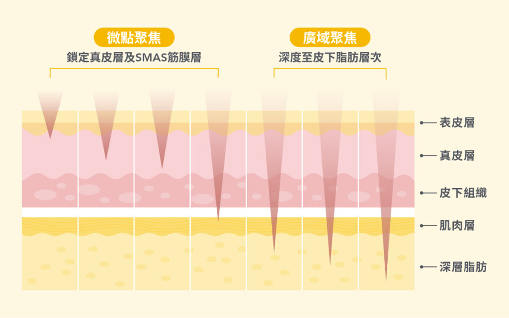 海芙音波電波一起打-2