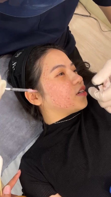 手打美白水光過程