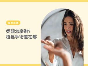 禿頭怎麼辦-1